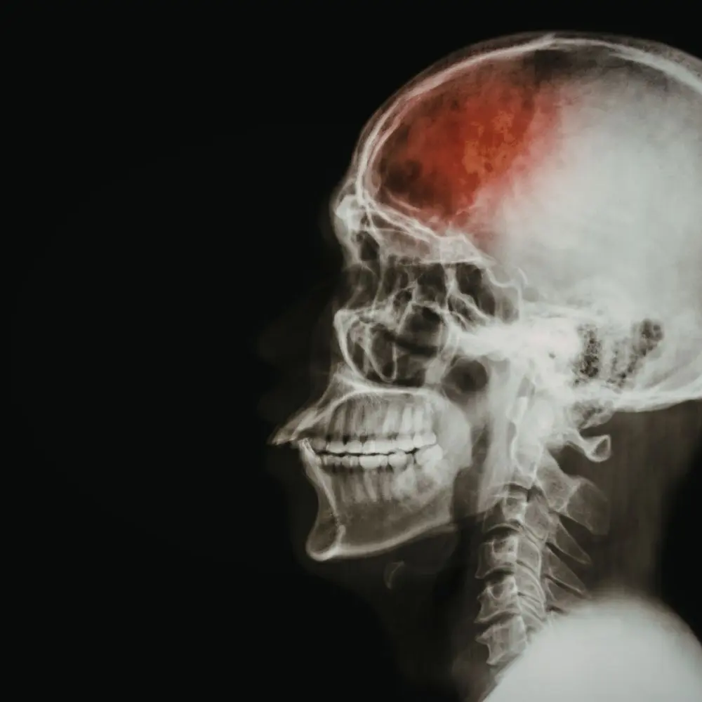 TRAVMA VE YAS EĞİTİMİ